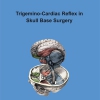 Trigemino-Cardiac Reflex in Skull Base Surgery-79